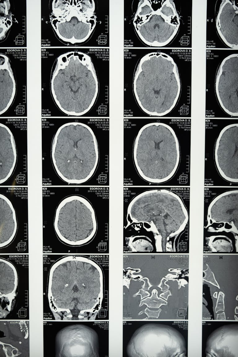 Comprehensive set of brain MRI scans highlighting cranial anatomy for medical use.